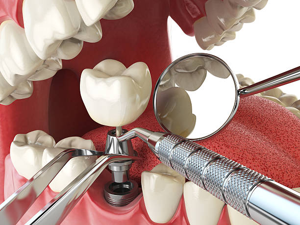 Reliable ID Emergency Dentist Solutions